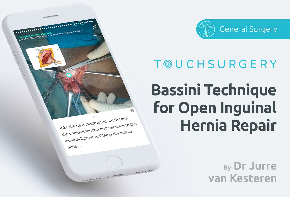 TouchSurgery's tweet photo. The Bassini technique provides a robust and cost-effective option for groin #hernia repair in limited-resource settings. Learn more with our latest sim in partnership with Amsterdam University Medical Centres https://t.co/MKjjQgCpIb
#SafeSurgery2020 #GlobalSurgeryAmsterdam https://t.co/ZSfrVNcytY