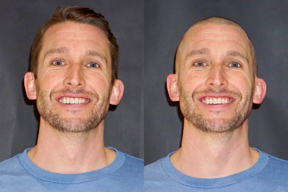 K_Schrammel's tweet photo. A big thank you to everyone who donated to St. Baldrick's this year. Together as a school, we were able to raise more than $10,000 to help fight childhood cancer! Here's a before and after shot! https://t.co/4otImC7YYH