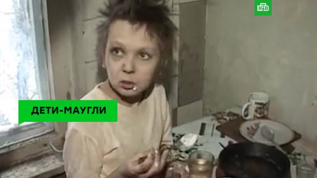 Сообщение о детях маугли. Витя козловцев мальчик маугли. Дети маугли вывод. Дети маугли вывод. Лечение синдрома маугли.