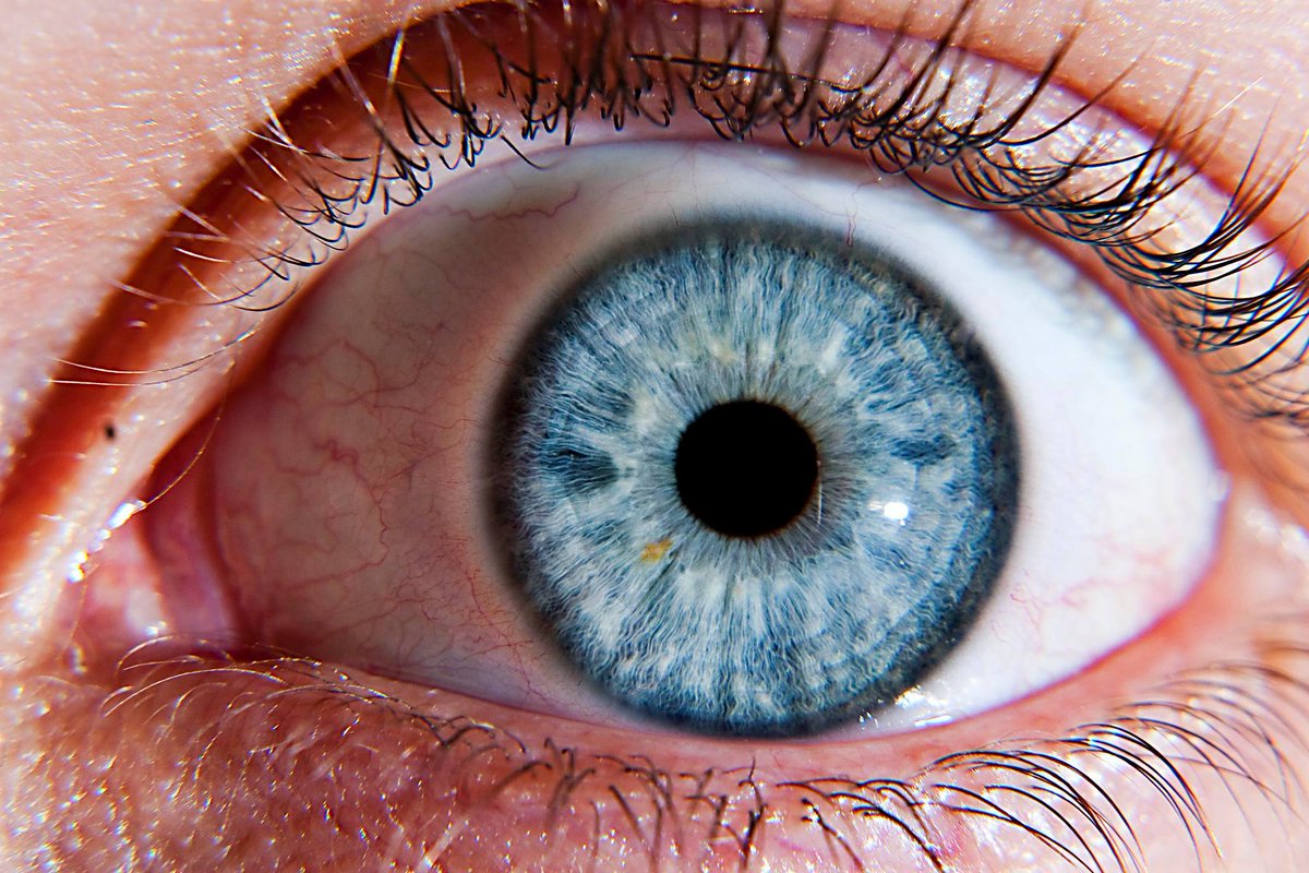 Esa Auf Deutsch Healthforall Immer Mehr Menschen Lassen Sich Die Augen Lasern Um Besser Zu Sehen Aber Wusstet Ihr Auch Dass Oft Weltraumtechnologie Bei Der Behandlung Dieser Form Der Augenkorrektur