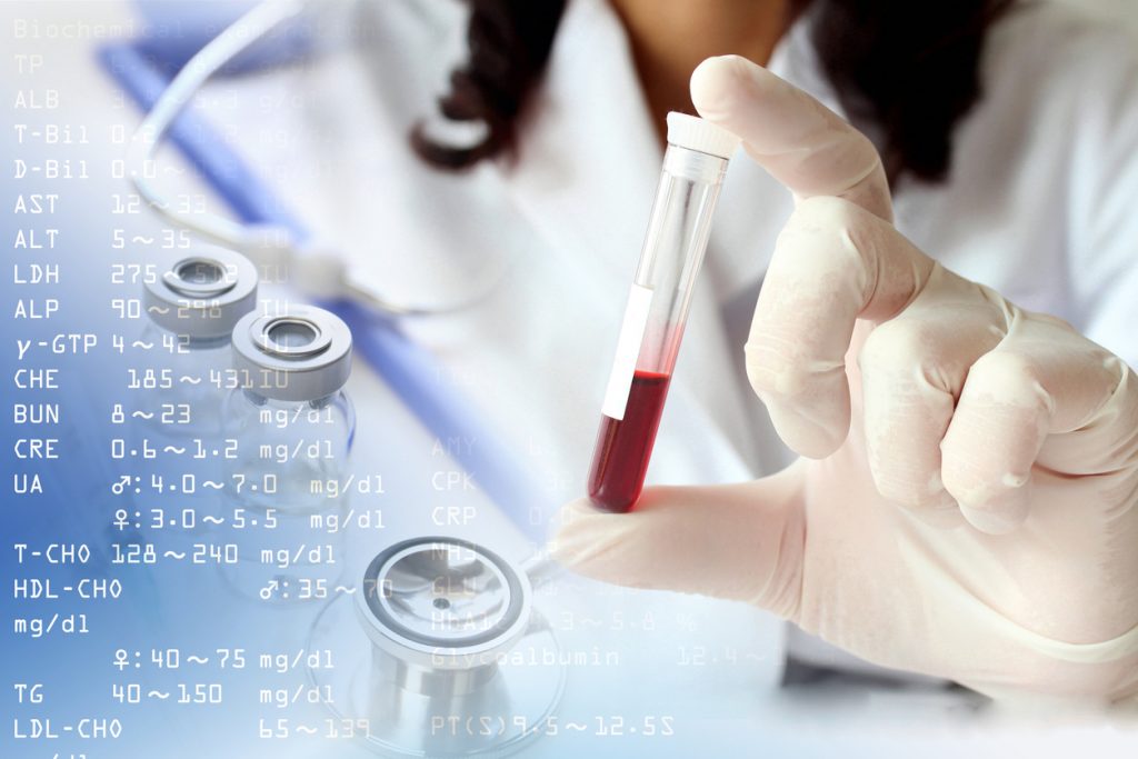 TestNACE's tweet photo. Test no invasivo en sangre materna: un plus de seguridad a partir de la semana 10. https://t.co/dVV9Jxnhfh #embarazo https://t.co/zA2xFkYHGP