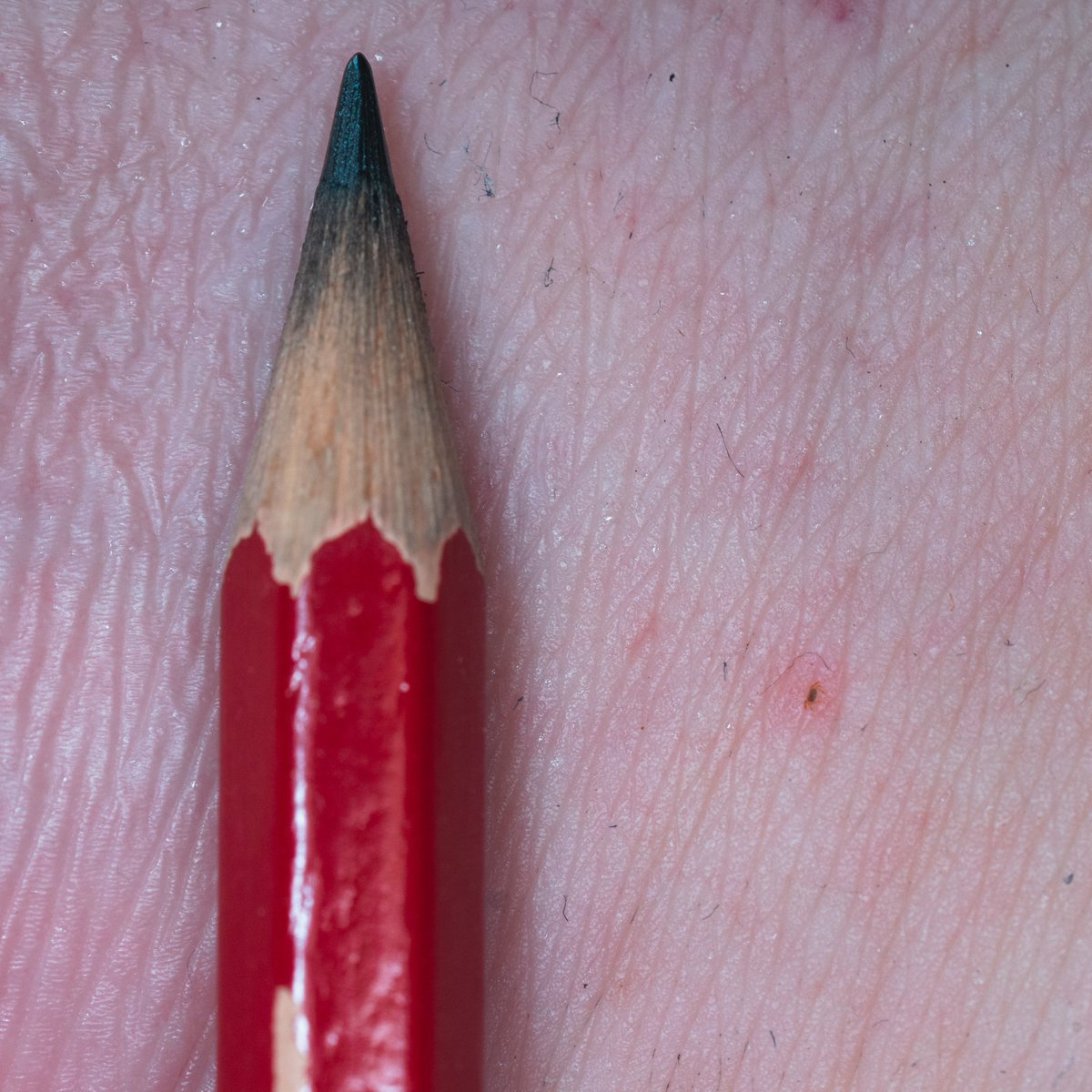 Dr Henry Lydecker tweet media