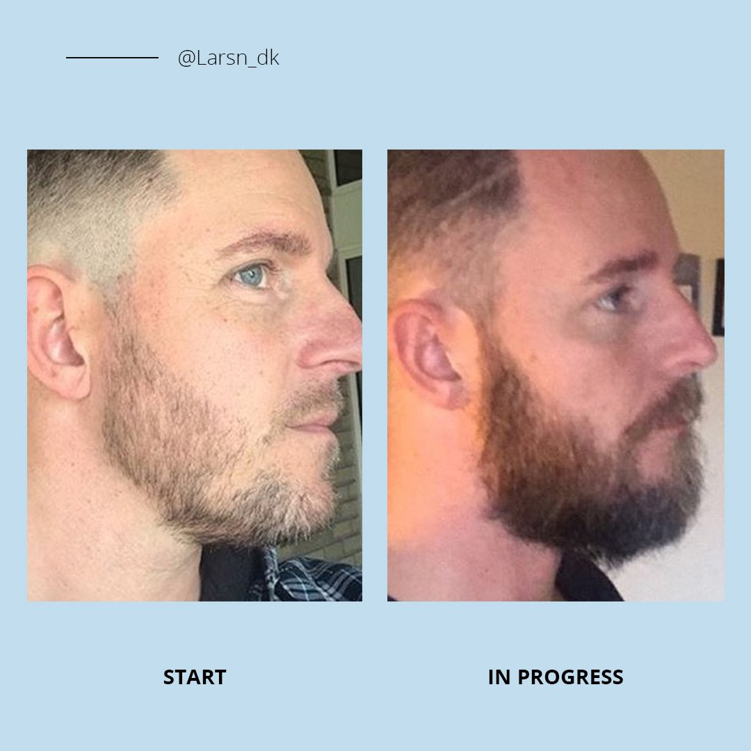 Copenhagen Grooming on Twitter ""This is after three months. I've used the Beard Growth Kit for