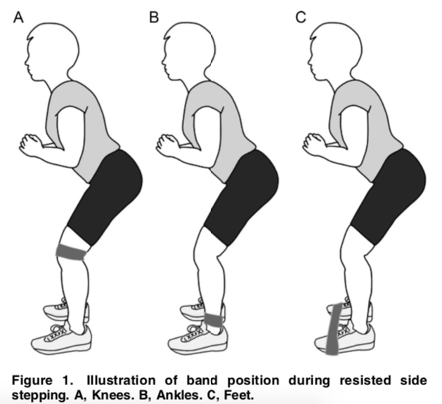 cfous_trades's tweet photo. 'Compared with placing the band around the ankles, placing the band around the feet for resisted side stepping elicited more activity in the gluteal muscles without increasing TFL activity.'
Research paper 📝
https://t.co/MbLOwpj84A https://t.co/ZQovbxLh4b