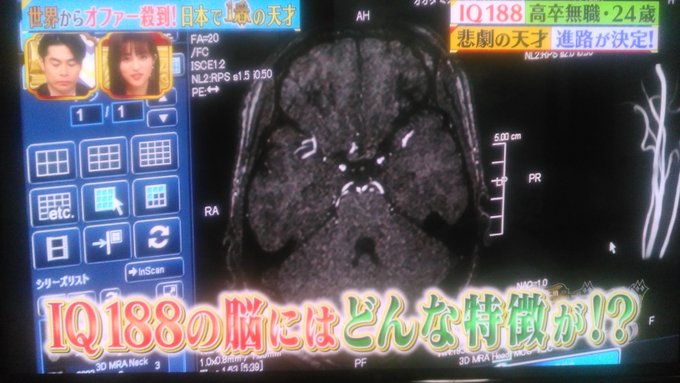 ひぐらし Iq1の太田三砂貴さんが披露したピアノが ひぐらしのなく頃に の You でネットざわつく まとめダネ