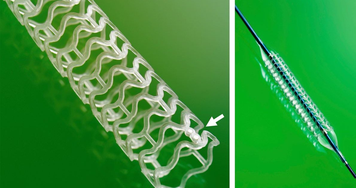 CRT_meeting's tweet photo. The first-generation Absorb #bioresorbablevascularscaffold (BRS or BVS) was associated with better coronary function at the level of the large epicardial vessel at 3 years, according to the #ABSORBII #Physiology #Substudy.

Read more: https://t.co/0LtMFrqhof https://t.co/WVSbgxL6E4