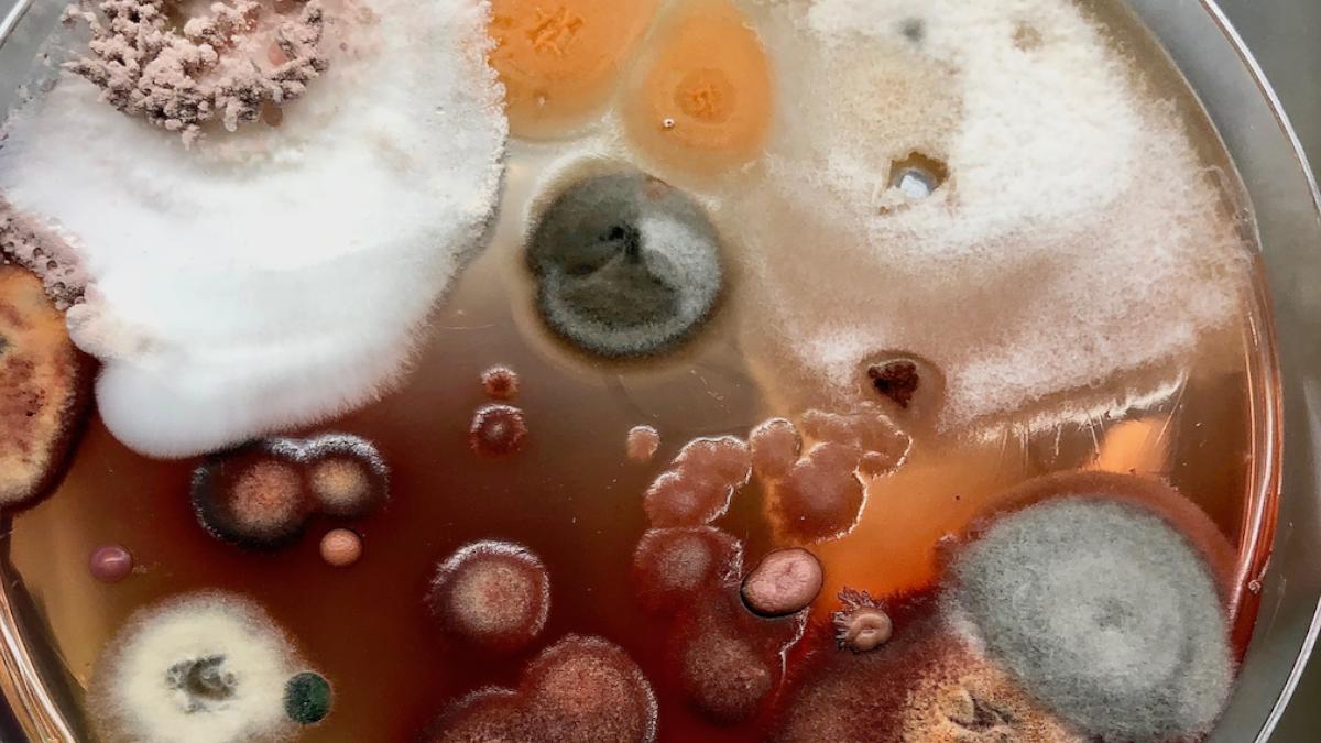 Indigoag's tweet photo. Talk about #biodiversity! On this petri plate there are more than a dozen fungal microbes that once lived in a single corn leaf.
#MicrobiomeMonday #IndigoScience #IndigoLabs https://t.co/D2Depkvo8t