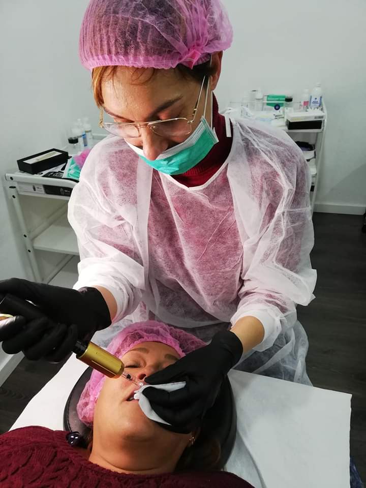 Formación relleno de arrugas y volumen de labios con ácido hialuronico sin agujas.
(Barcelona)
