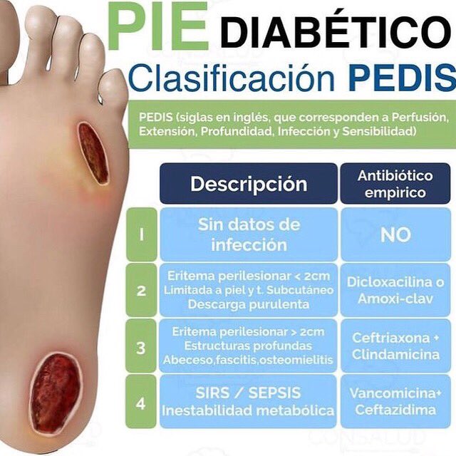 IDTADiabetes's tweet photo. Clasificación que utilizan los profesionales para el diagnóstico de pie diabético  

#idta #idtadiabetes #pie #piediabetico #diabetesgestacional #diabetesmellitus #diabetestipo2 #diabetestipo1 #diabetologia #endocrinologia #salud #medicina https://t.co/InILmGZxpp