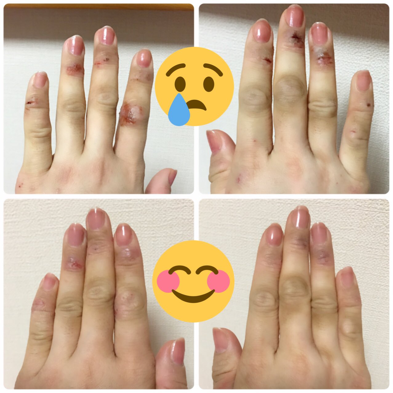 𝒮𝓊ℯ Pekoro4649 飲食も手荒れ辛いよね W スイーツ大好きだから働きたかったけど 手荒れ治らないやんってなって諦めた 頑張って治します モンそーちゃんまでありがとう かわいい W なでなで なでなで モフモフ Twitter