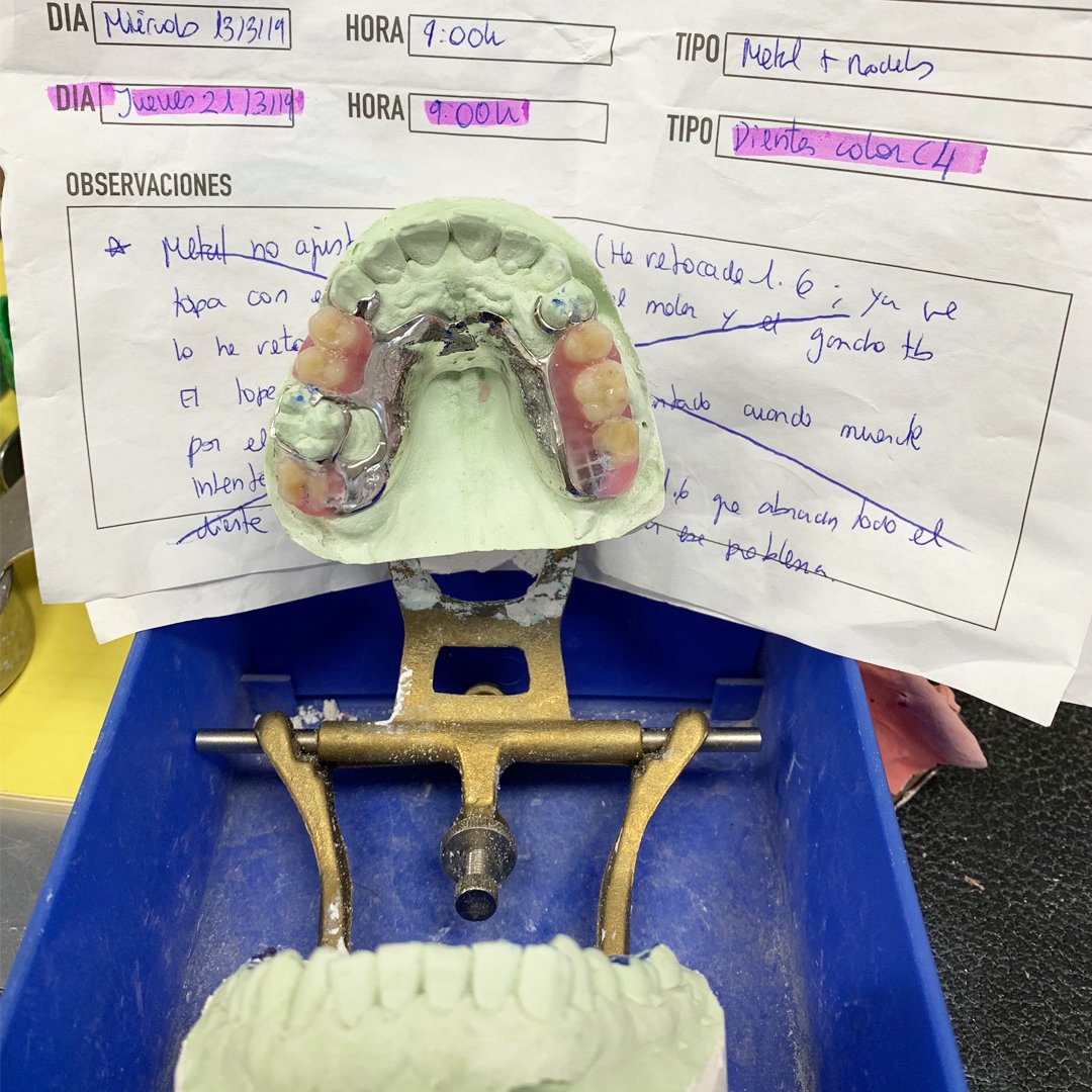 jpdentallab's tweet photo. #LaboratorioDental Vamos más allá de la elaboración de #ProtesisDental Ayudamos a nuestros Doctores🦷 a definir resultados, Ej obtener pruebas optimas de sus pacientes
🤔 Objetivo? Conseguir prótesis dentales adecuadas a cada paciente 🙌🏻 #BadalonaDental 👉 https://t.co/NIUUxGCKNG https://t.co/t9XVwj9png