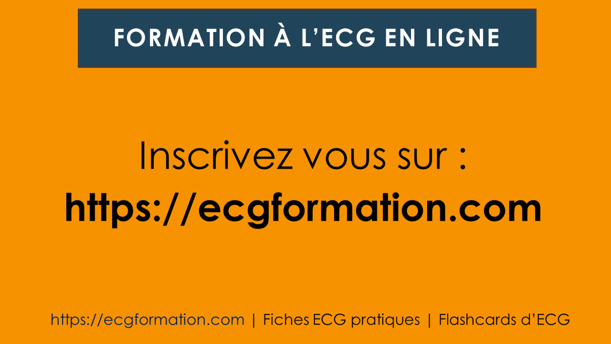 EcgFormation's tweet photo. Formation à l'ECG en ligne.
#ecgformation #ecg #ekg #electrocardiogramme #cardiologie #cardio #formationecg #medecine https://t.co/muSPSjgnTF