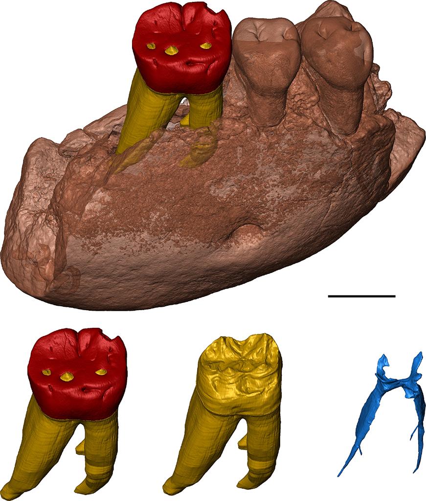 Our new study on hominid fossil remains from Indonesia now attributed to  a new genus of ape (Meganthropus palaeojavanicus) has been just  published on Nature Ecology &amp; Evolution (image from Clément Zanolli): nature.com/articles/s4155…
