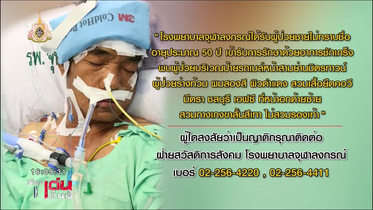 รพ.จุฬาฯ รับชายไม่ทราบชื่อเข้ารักษารายละเอียดตามในภาพ

ฝากแจ้งญาติผู้ป่วยค่ะ 
#ch3thailandnews