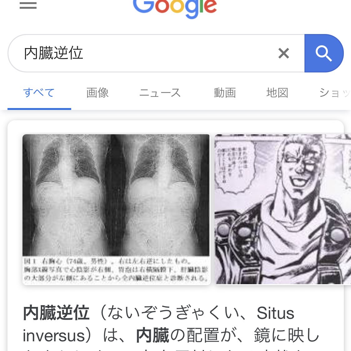 99歳の女性 献体で5000万人に一人の内臓逆位症だったことが判明して北斗の拳のサウザーを思い出す人々 3ページ目 Togetter 99歳の女性 献体で5000万人に一人の内臓逆位症だったことが判明して北斗の拳のサウザーを思い出す人々 3ページ目 Togetter
