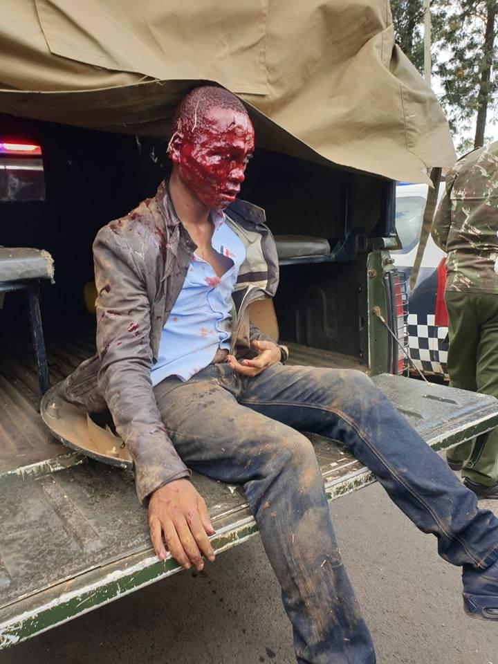 Moi University Female Student, Kenya Hacked By Boyfriend In Broad Day Light