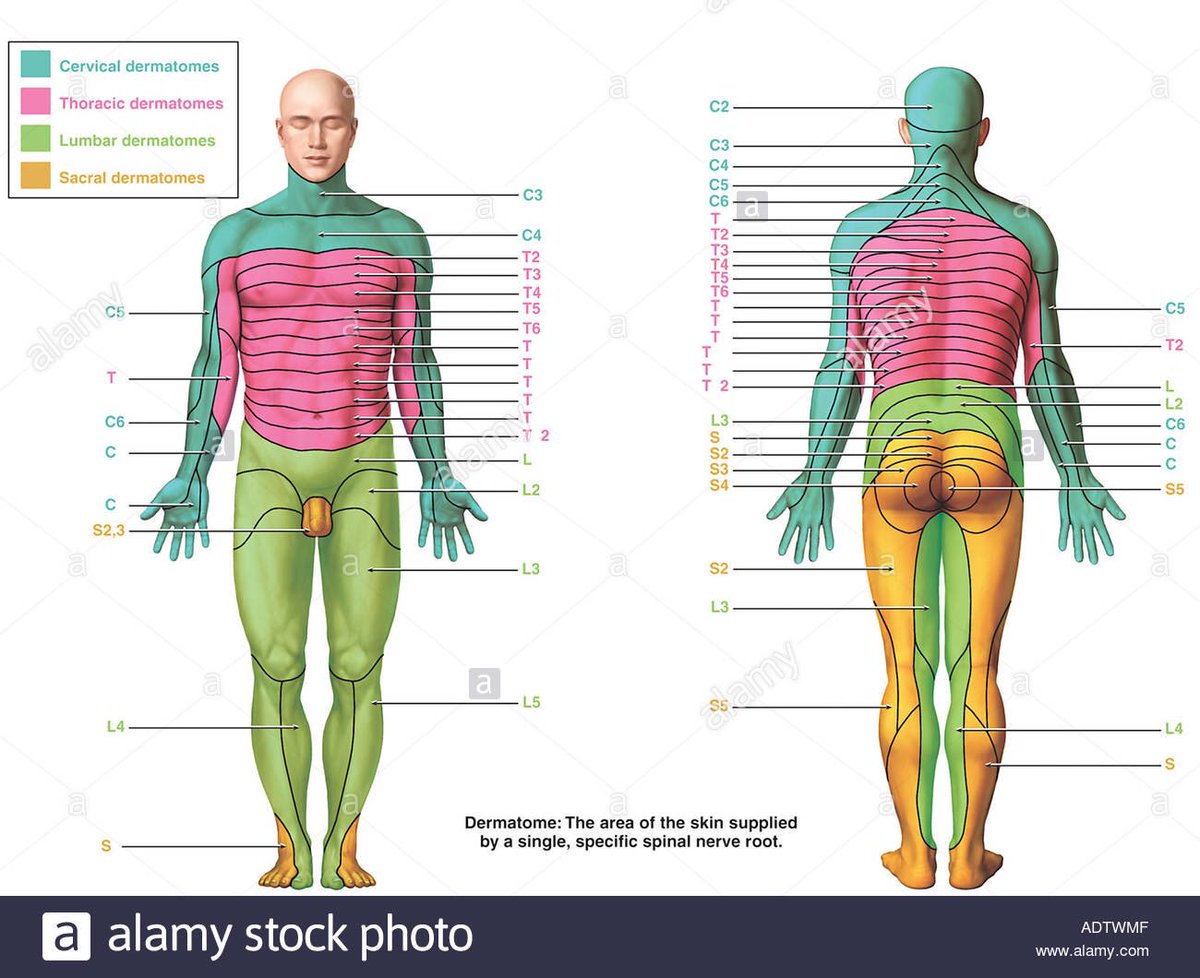 Dermatomes are used to help make a diagnosis of where musculoskeletal probl...