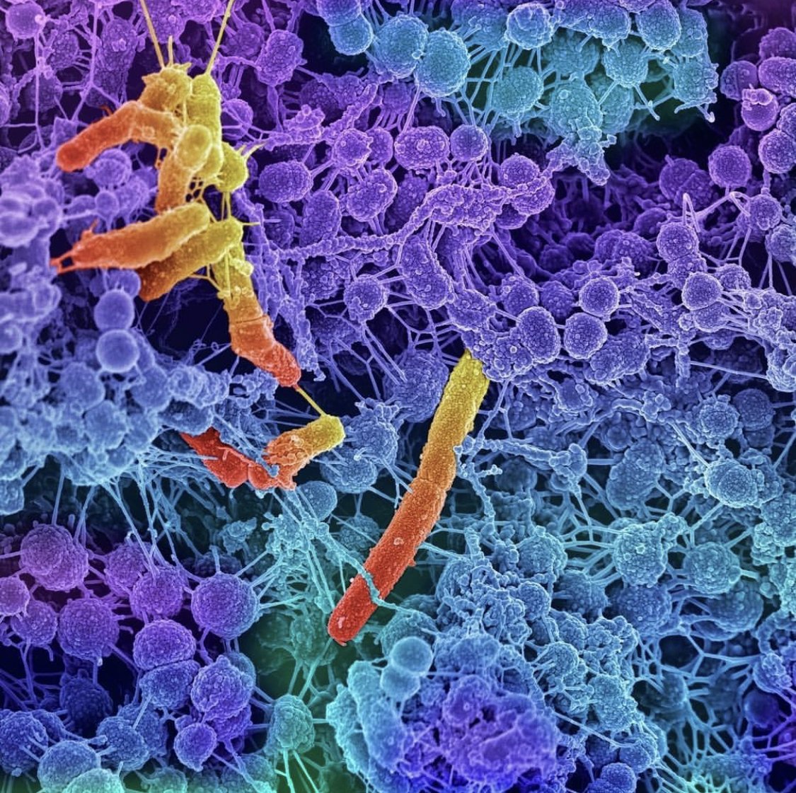 Ever wondered if you have SIBO and/or what it even *means*? We've got answers.

Symptoms of SIBO are nonspecific and include:

Abdominal pain/discomfort
Bloating
Abdominal distension
Diarrhea
Flatulence
Weakness

Talk to a Doctor today! vitamindrip.com/findadoctor

#VitaminDrip #SIBO