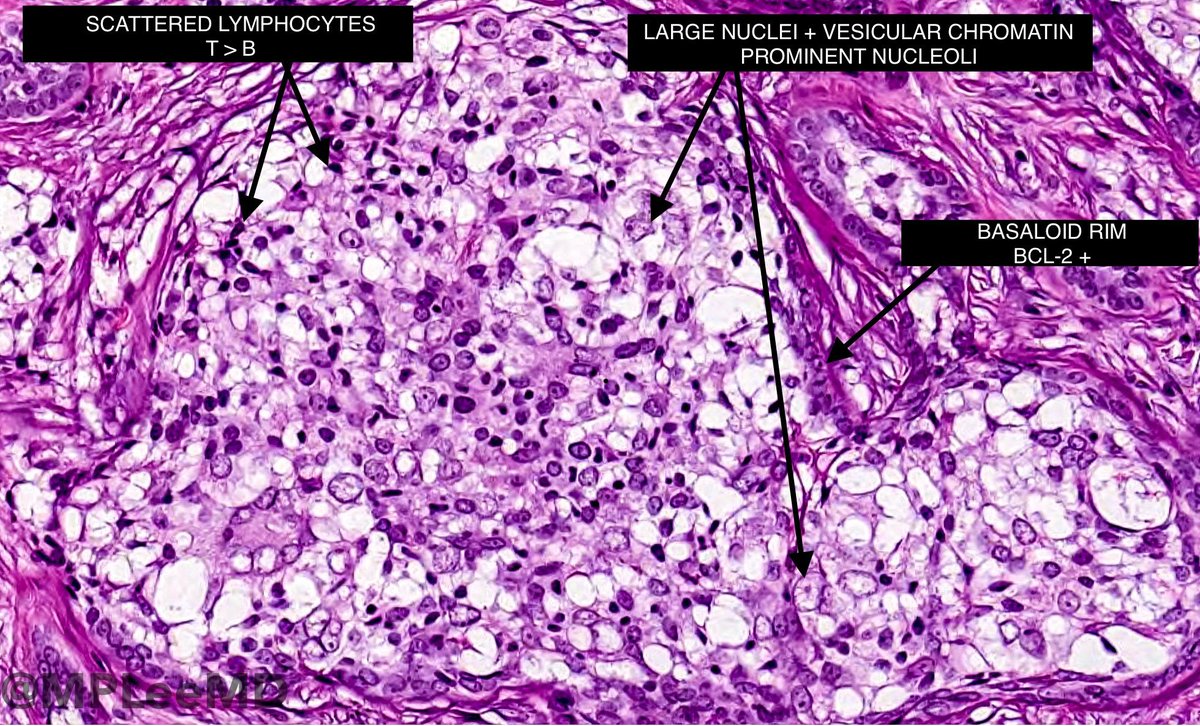 Michael P. Lee MD tweet media