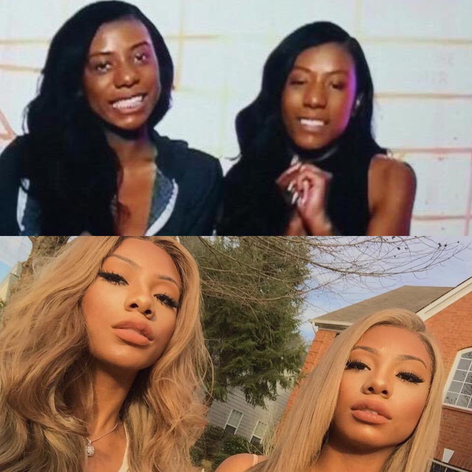 Clermont twins before and after ? 