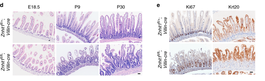 Intestinal_Cell's tweet photo. Recent research demonstrates that zinc finger HIT-type containing 1 of the SRCAP chromosome remodeling complex is essential for Lgr5+ #StemCell maintenance and gut epithelium homeostsis. #IntestinalCells @NatureComms https://t.co/UPQRHjRlqo https://t.co/nRBwqcb44Z