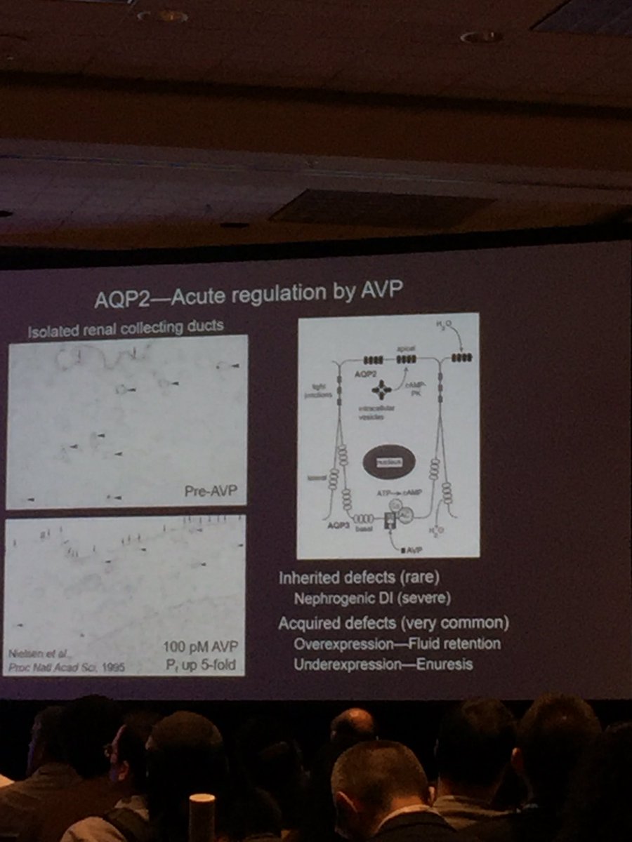AnberithaT's tweet photo. #AQP1 is found in varying body systems. #vascular #pulmonary #neuro according to Dr. Agre @expbio during the @NobelPrize Lecture @APSPhysiology. These #data were a concerted effort of several #investigators. @AHAMeetings #ExpBio #ExpBio19 @AdePhd @JunieWarrington https://t.co/ZPGAoQ04Nh
