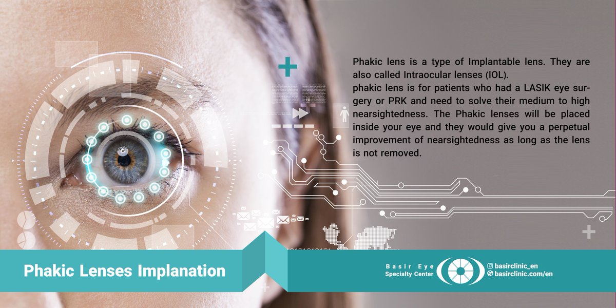 Basirclinic's tweet photo. One of the advantages that phakic IOL have over the contact lenses is that you will not feel it inside your eyes. In addition, they need no maintenance.
Read more and get a free quote: https://t.co/zeTH8JFrMX
.
#eye #ophthalmology #basireyeclinic #LASEK #medicaltourism https://t.co/wVALMzPbdK