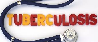 VumaFM's tweet photo. #TillNoon with @VanessaMarawa @SihleMvundla on the #DoctorsRoom @ 10:20am we talking about TB , Cause of TB and how it can be treated @healthza @kzngov https://t.co/2oRCM3XiS5