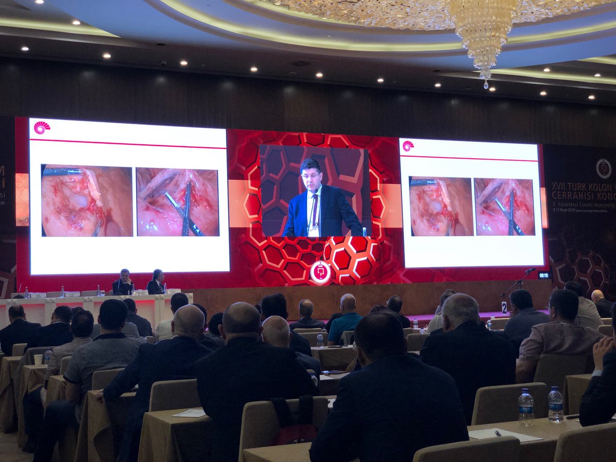 Prof Dr Emre Balık kolon kanserinin optimal tedavisi konusunda mükemmel bir konuşma yapıyor...
#TKRCD2019, #emrebalik