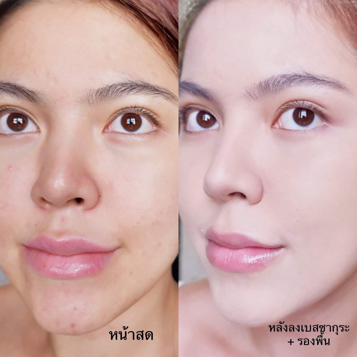 พอเริ่มหันมาลงเบสก่อนลงรองพื้น ก็รู้สึกว่าหน้าดูเนียนมากขึ้น 90% คือรองพื้นดูสมูทขึ้น ปิดรอยได้มากขึ้น ติดทนมากขึ้น แต่ตกร่องและเป็นคราบน้อยกว่าเดิมเยอะเบสที่ใช้จะเป็นของ Cherry B อันนี้ดีสุด All in one นอกจากจะเป็นเมคอัพเบสที่ทำให้แต่งหน้าเนียนขึ้นแล้ว ก็ยังเป็นโทนอัพ(1)