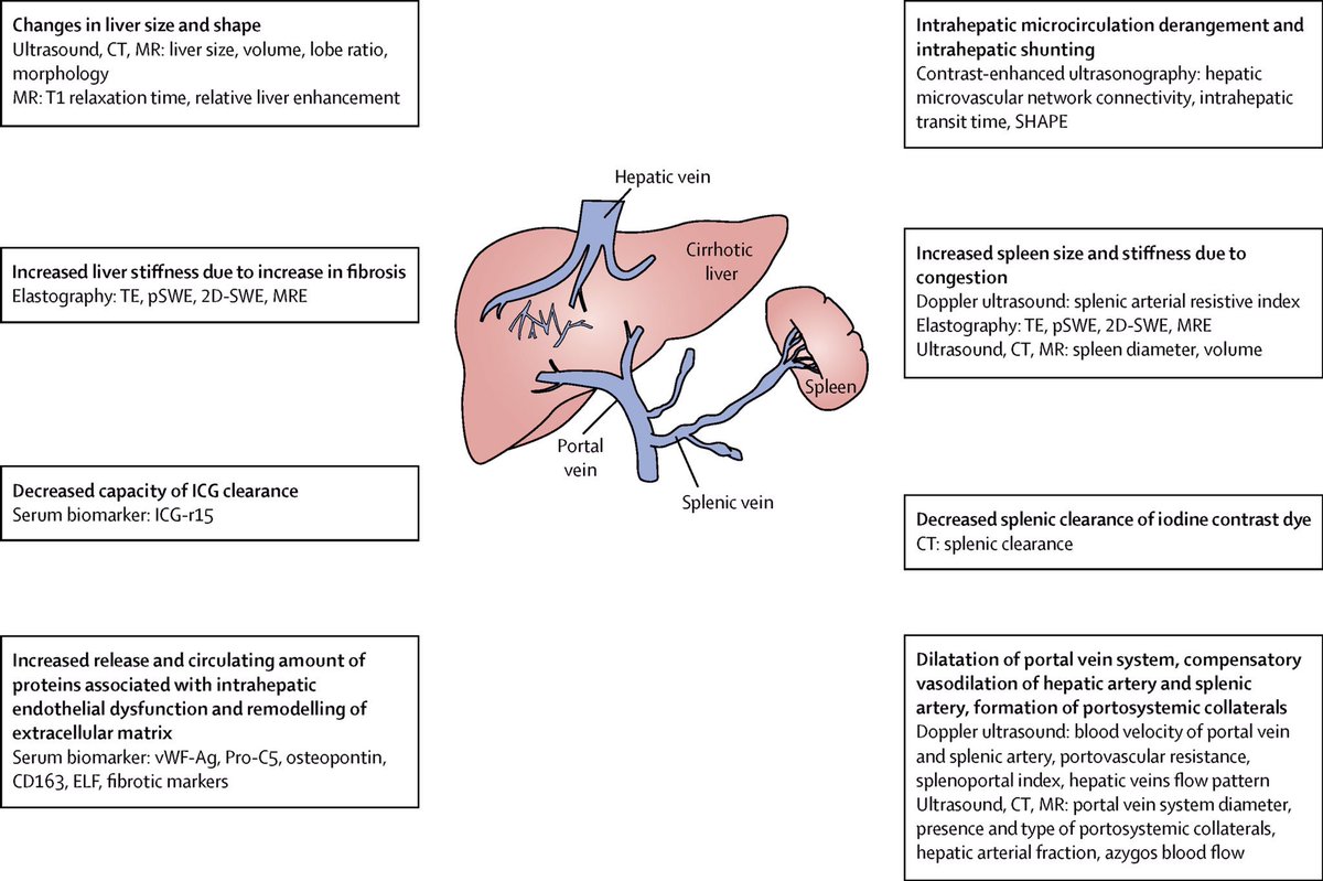 The Lancet Gastroenterology & Hepatology (@lancetgastrohep) on Twitter photo The #ILC2019 post-grad course moves on to discuss on diagnosis of #portalhypertension. Essential reading on emerging non-invasive techniques for diagnosing portal hypertension here: thelancet.com/journals/langa… <a href="/xiaolong_qi/">Xiaolong Qi</a> <a href="/EASLedu/">EASL Education</a> <a href="/EASLnews/">EASLnews</a> The #ILC2019 post-grad course moves on to discuss on diagnosis of #portalhypertension. Essential reading on emerging non-invasive techniques for diagnosing portal hypertension here: thelancet.com/journals/langa… <a href="/xiaolong_qi/">Xiaolong Qi</a> <a href="/EASLedu/">EASL Education</a> <a href="/EASLnews/">EASLnews</a>