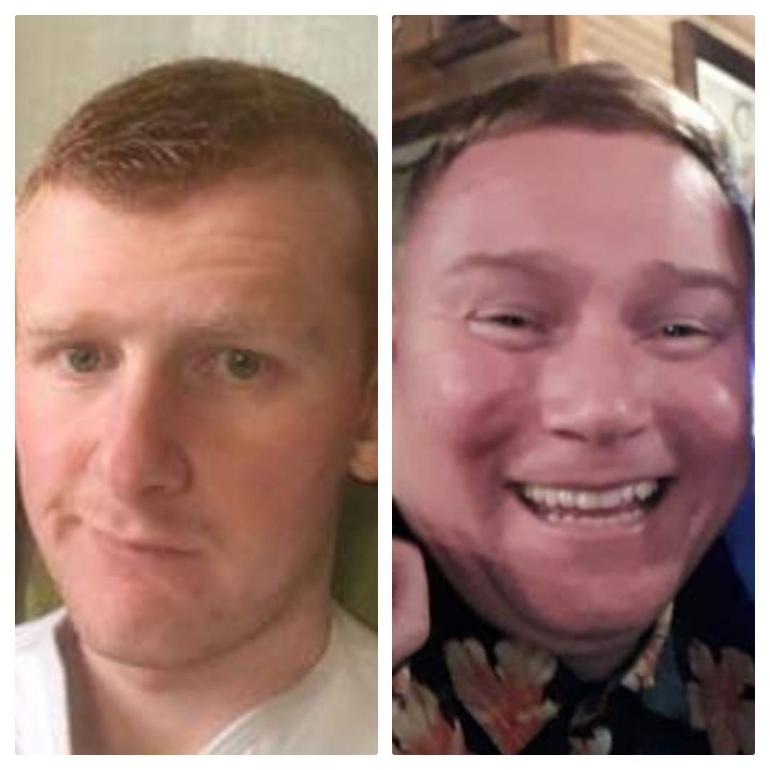 Pre leg break Tiger 🐯💪/ Post leg break Tiger 🤰🐯 #NoGymJustZilan