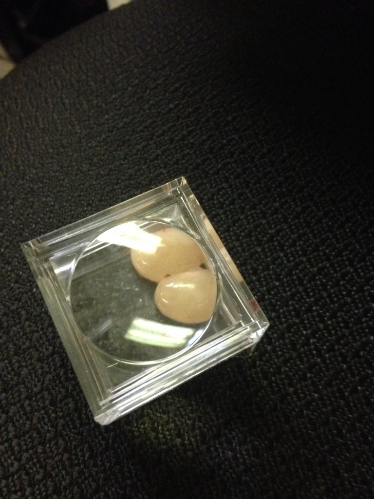 ScienceNana17's tweet photo. Only a "true" science teacher would dig the eggs from a dead snake that a parent brought her in a Tupperware container.  #power2thepurple #eesadmin https://t.co/IGwIiyScr0