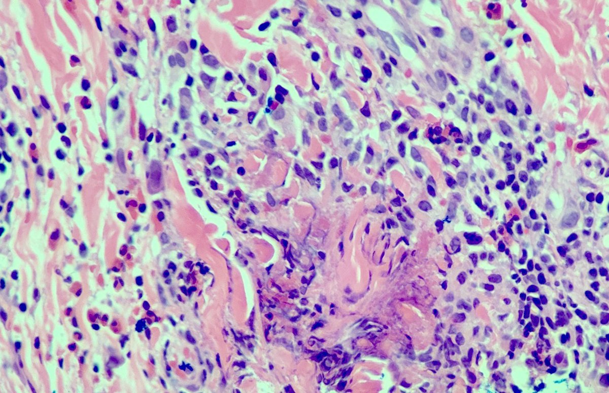 MPathy Art/Mary Landau tweet media