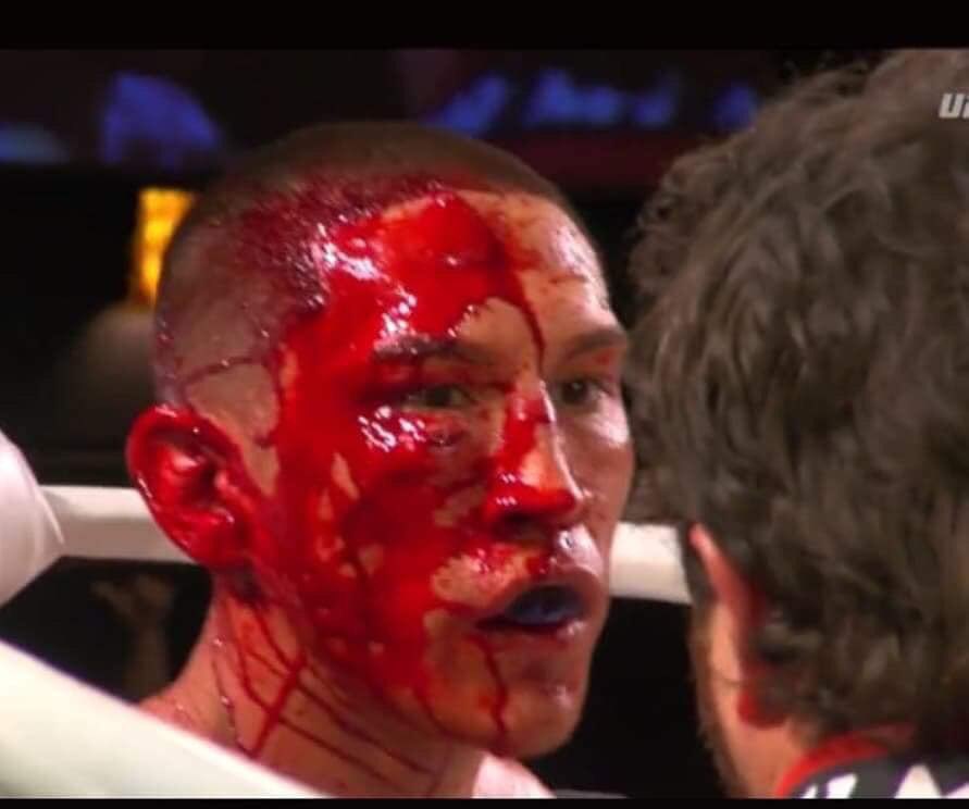 Nothing But Respect 🙏🏽 For My Opponent. I Knew He Was Very Tough &amp; Experienced &amp; I Knew I Was Going To Be In A War!