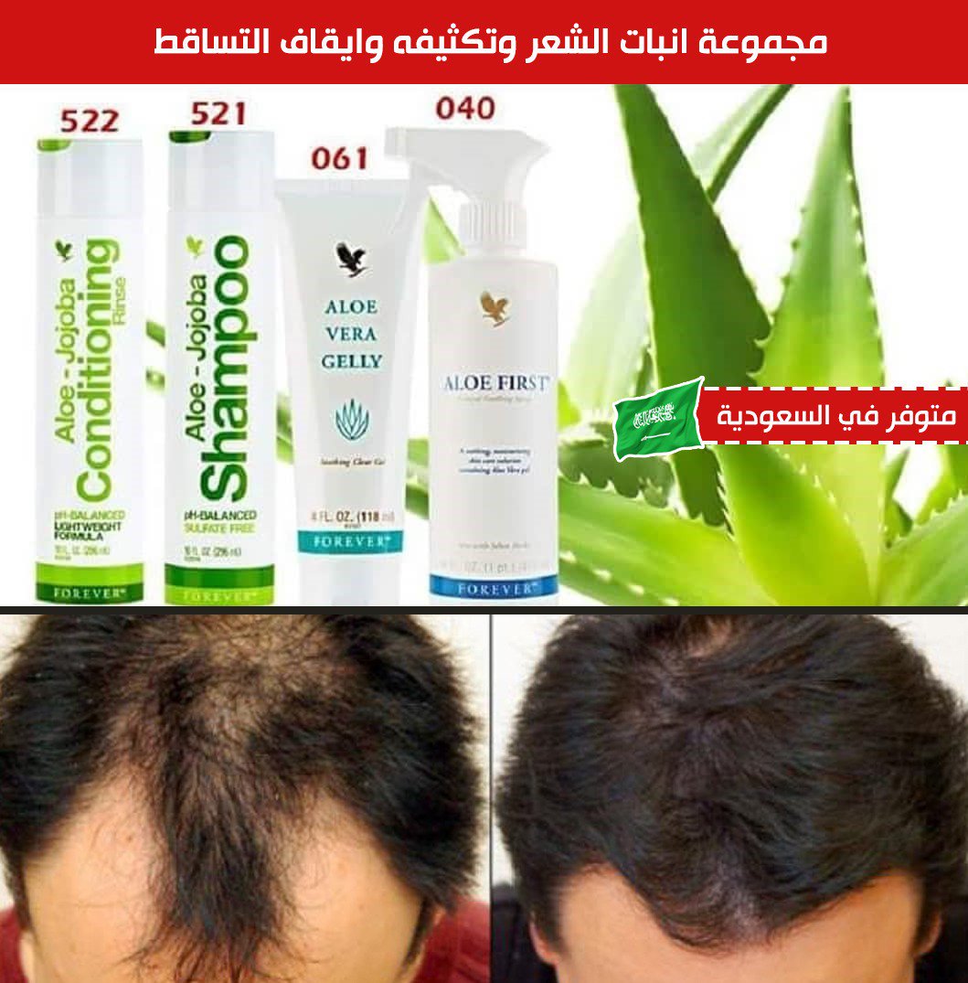 salma0599's tweet photo. مجموعة علاج تساقط الشعر🔥
وإعادة انباتة وتطويله للرجال والنساء
والحفاظ على نعومته والترطيب

⚡يقضي علي تساقط الشعر
⚡ويعيد انباته في شهر فقط
⚡يعالج فراغات الراس
⚡يعالج أيضا الصلع الوراثي
 
آطلبه واتس في أول تعليق📩
#الثًقَبِ_اَلاِسوَدِ
#حِفلَ_جاَيِزهَ_نجِوَمِ_الِسَلاِمَ https://t.co/PlEIATFpu2