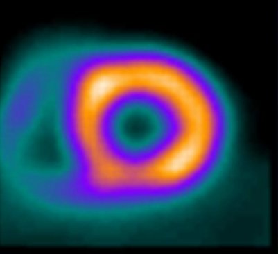 FDangerMD's tweet photo. BREAKING NEWS

First-ever image of a #BlackHole.

... 😅 😇

#radres #radhumor https://t.co/GcIEUyK9nq