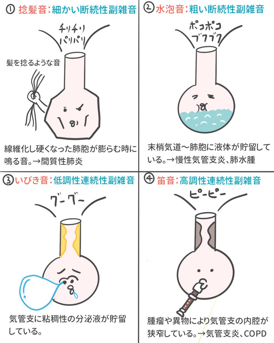 Twitter 上的 ゴロ 解剖生理イラスト 四コマで分かる 異常呼吸音 副雑音 の分類 とりあえず この4つは抑えとくべし T Co X8rvrzxmvz Twitter