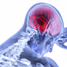 Listen to CIMTR's Professor <a href="/joefach/">Jorg Fachner</a> and Dr <a href="/alexstreetuk/">Dr Alex Street</a> speak about the evidence for #musictherapy for mental health and brain injury rehabilitation on the <a href="/NakedScientists/">The Naked Scientists</a>' 'Can music be medicine?' podcast: 
buff.ly/2XI5fXB