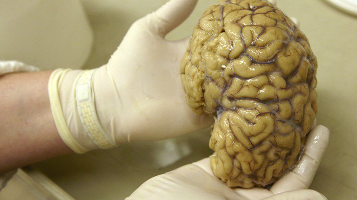 CaraSantaMaria's tweet photo. Scientists partly restore activity in dead-pig brains. Now what?
#BrainResearch #Pigbrains #Oxygen #Brainssss #Tech
https://t.co/IkTYeLYix5 https://t.co/X07l2LH5ap