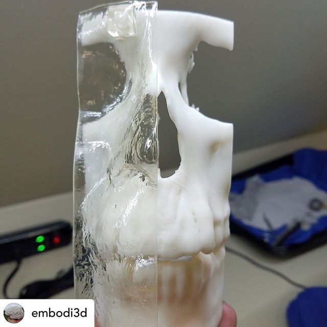 3dheals's tweet image. Posted @withrepost • @embodi3d #3Dprinting in transparent plastic. An example of how @Embodi3D uses multiple materials to make #medicalmodels more useful. #3dmedicalprinting #anthropology @tsehrhardt bit.ly/2UAdyCu