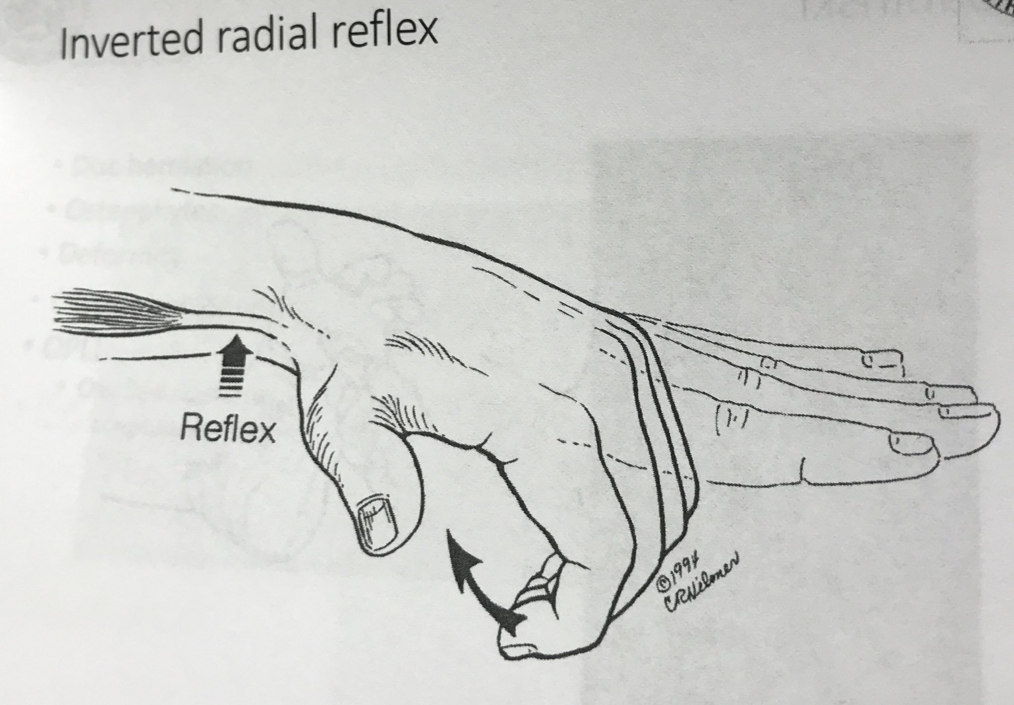 Jess Zimbabwe on Twitter "These are diagrams of reflex tests that we