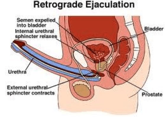 bladder Sperm ejackulating into Gavin recommend Reena sky dp