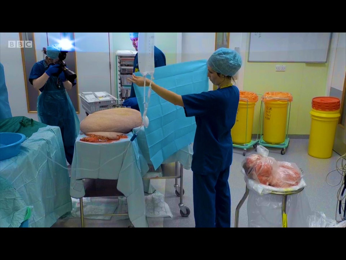 #Featured quickly on the #bbc last night on #surgeons #edgeoflife ... I love my job as a #clinicalphotographer, I get to see so many amazing things! The #QE #Birmingham is a brilliant #hospital full of talented #medical professionals!
