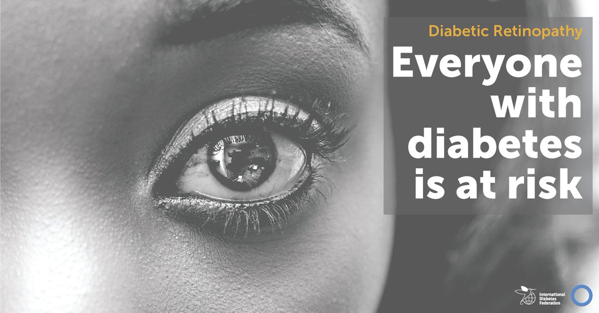 IntDiabetesFed's tweet photo. Eye complications in #diabetes may not display symptoms until an advanced stage. Regular eye examinations are key to reducing the impact of this common and serious complication. https://t.co/amkhRUs9kA https://t.co/lyNuOuwqmw