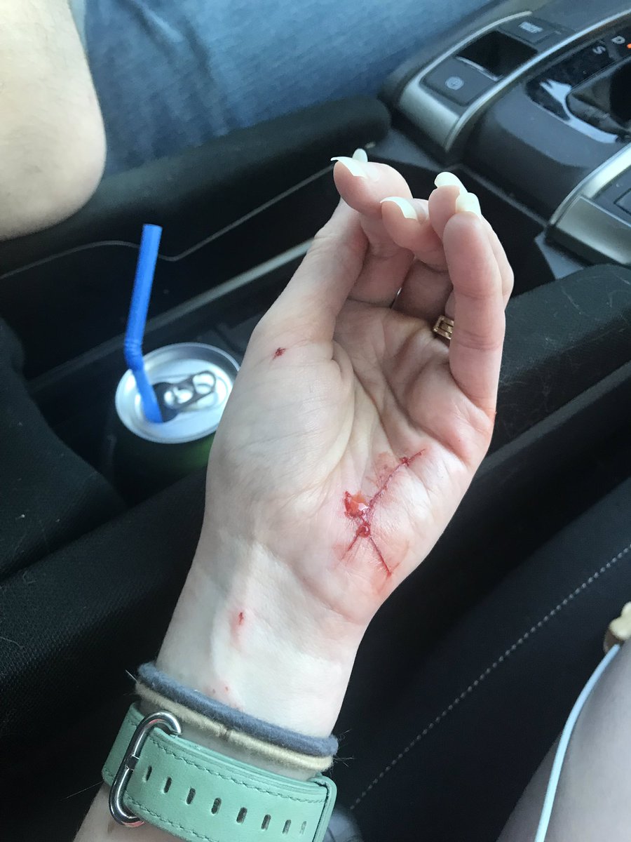 Buttercup5_12's tweet photo. The day Ash came home from his snip snip surgery vs the day Newt came home. #ouch #nowadogperson #CATastrophe 😿 https://t.co/adf9ThTP6W