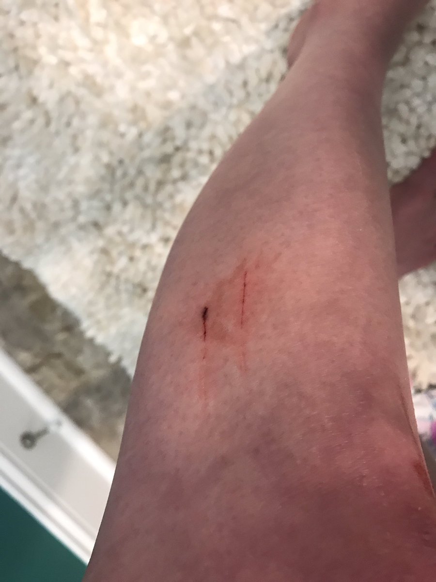 Buttercup5_12's tweet photo. The day Ash came home from his snip snip surgery vs the day Newt came home. #ouch #nowadogperson #CATastrophe 😿 https://t.co/adf9ThTP6W