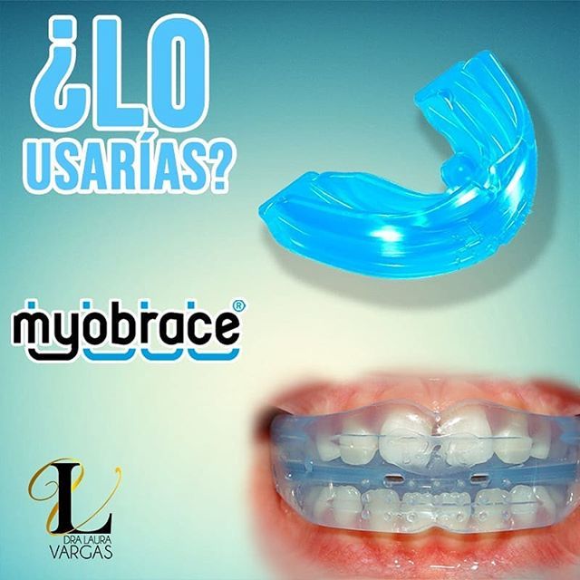 dralauravargas's tweet photo. ✨La magia de usar #Myobrace es la hermosa alineación que le da tus dientes.😁
.
Te invito a usarlos y a comprobarlo por ti mismo.🤗
.
#Odontología #familia #Dralaura #lauravargas #panama #Panamapty #salud #bienestar #dientes #Myobrace https://t.co/4Hr9NFFNlt https://t.co/OU9Vu7qgvU