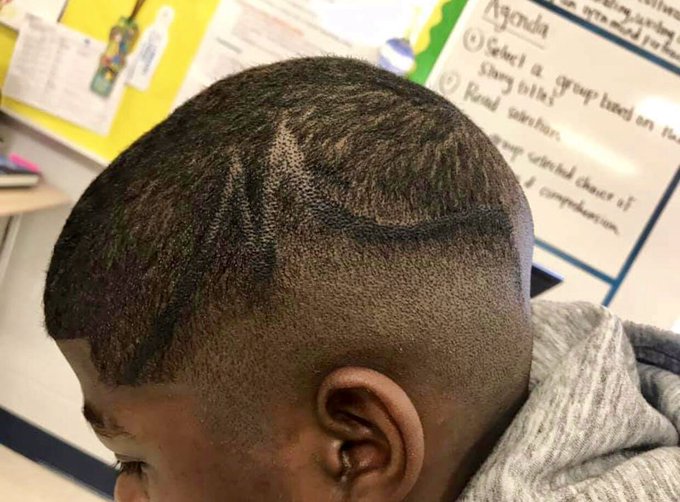 Lawsuit: White School Employees Laugh as Black Boy's Scalp Colored With Jet-Black  Permanent Marker