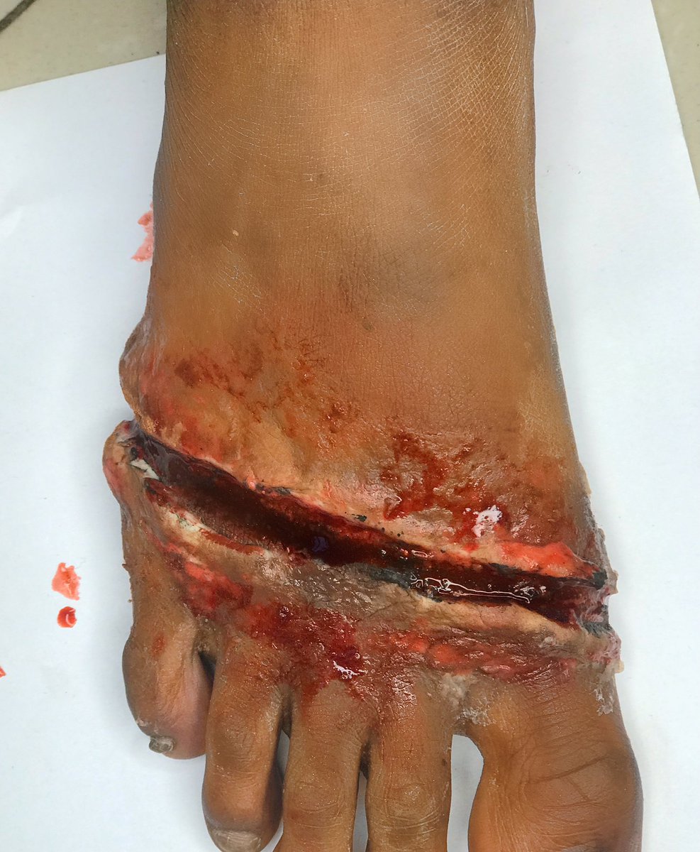 FirdaBako's tweet photo. #makeupartistinlagos #bodypainters #makeup #art #bodypaint #sfxmakeup #sfx #sfxmakeuptutorial #sfxgore #sfxmua #sfxtutorials #sfxwound #sfxblood #sfx_members #sfxartistsofinstagram #sfxwound #sfxprosthetics #makeupsfx #sfxhorror #sfxartistsofinstagram #sfxmakeupart #sfx_members https://t.co/WMP3wH6AsZ